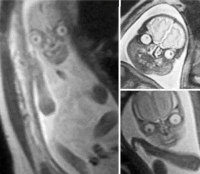 Boxcutter - Zdjęcia ludzkiego płodu z rezonansu magnetycznego. To chyba wyjaśnia dlac...
