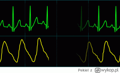 Pekiel - @sandal: otóż nie, rysuje się od lewej do prawej,