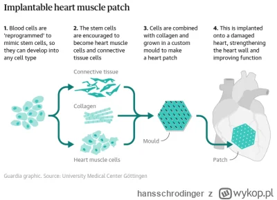 hansschrodinger - Bardzo fajne znalezisko o naprawie serca po zawale.

https://wykop....