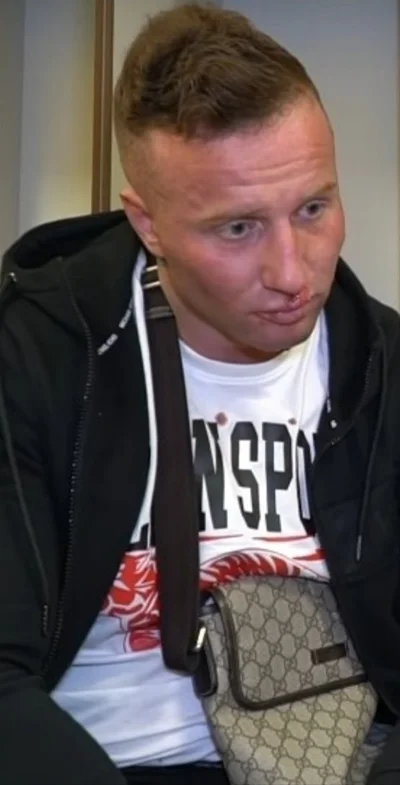 BombaskaEskadraLotnicza - #famemma 

Denis nie wygląda zbyt zdrowo. Ostatnie dwa dni ...