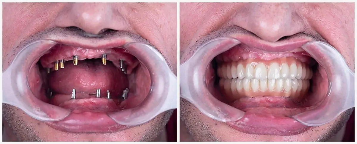 giorgioborgio - #kpo #afera Ja nie żadne jachty dla wieśniaków, tylko bym sobie szufl...