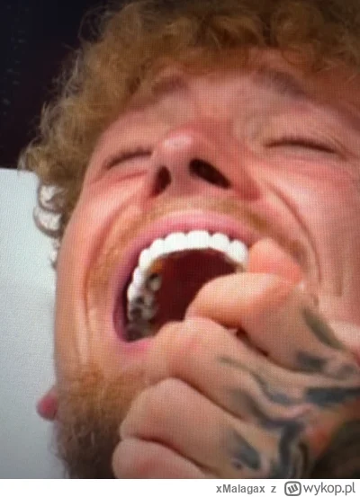 xMalagax - #hotelparadise Chłop zrobił sobie klawiaturę w Turcji tylko po to żeby ter...