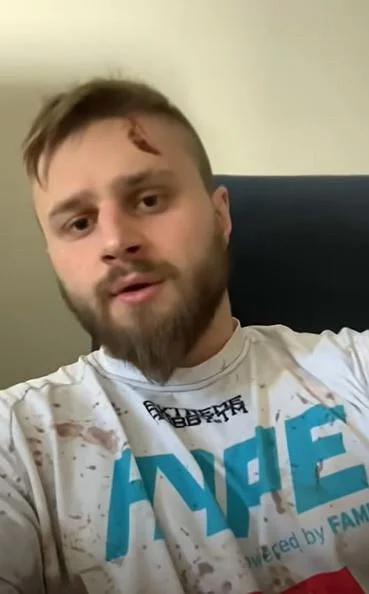 sperg44 - 1 plusik = 1 mela na cygańskiego farmazona 
Zamiast żebrać o plusiki dwoma ...