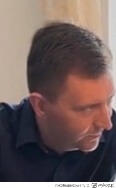 niezdiagnozowany - #famemma