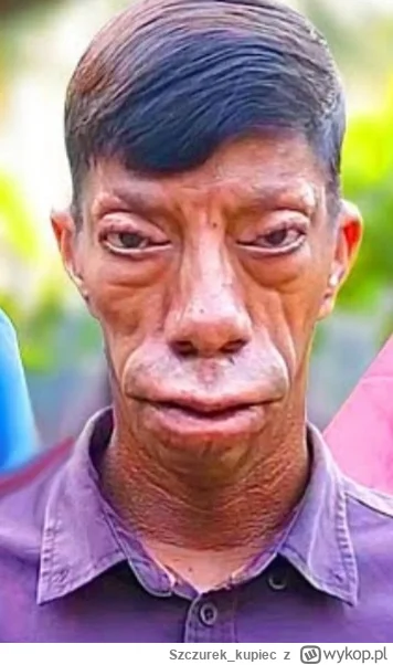 Szczurek_kupiec - #bonzo akat kobra się na nas patrzy