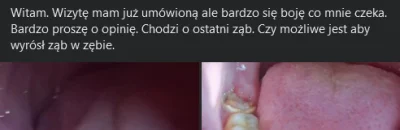 affairz - #dentysta czy możliwe jest aby wyrósł ząb w zębie? ( ͡° ͜ʖ ͡°)

SPOILER