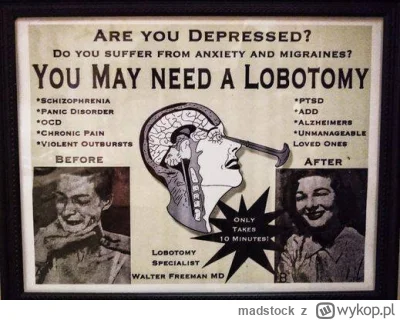 madstock - w 1947 r. na depresję proponowany lobotomię #zaufajnauce