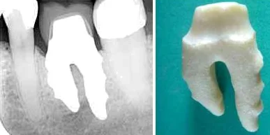 affairz - ciekawostka #stomatologia - jest taki innowacyjny choć nie pozbawiony wad s...