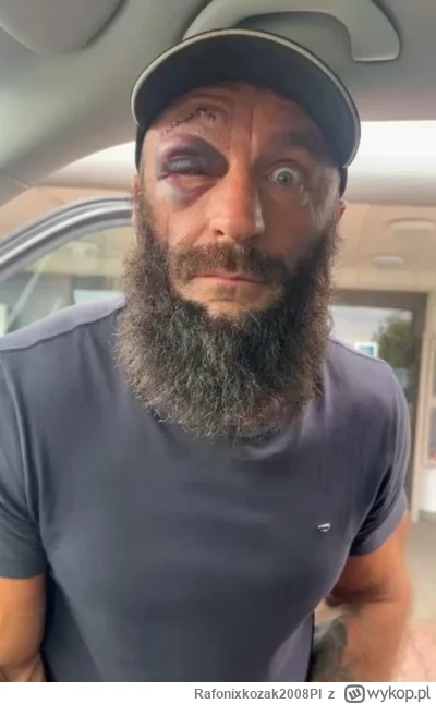 Rafonixkozak2008Pl - księciuniu dej ze 2 złote #famemma