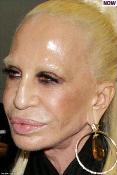 U.....e - @Marcepanowy_Detektyw: no nie wcale, mordą naciągnięta i nabotoksowana. Nie...