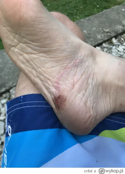 cr6d - Przebila mi wczoraj gałązka buta i wbiła sie w nogę tworząc taką ranę jak na z...