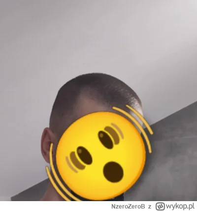 NzeroZeroB - Chciałbym zapuścić włosy, problem w tym że mam dość rzadkie te włosy, ta...