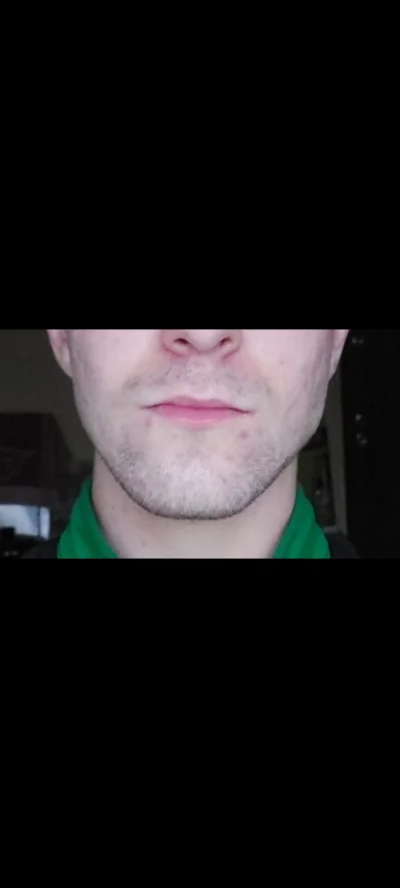 Paulus7911 - Czy z taką żuchwą ma szansę na Julke? 
#przegryw #pokazmorde #blackpill ...