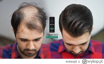 m4xejd - @Zarysxd:  na moje oko używa włosów w sprayu