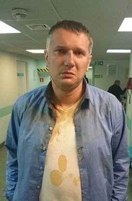 CrazyZdzich - @PiccoloColo: Chciałbym zobaczyć film z monitoringu, bo trochę wątpię, ...