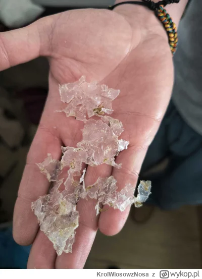 KrolWlosowzNosa - Mały update, z akcji pies zjadł plastik, a konkretnie wkład do znic...