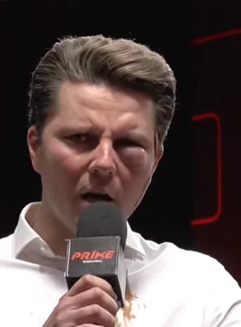 KIaudik - TO JEST MOZLIWE STOIMI POD ZABKA I TO JEST MOZLIWE XDDDDDDDDDDDDDDDD 
#prim...