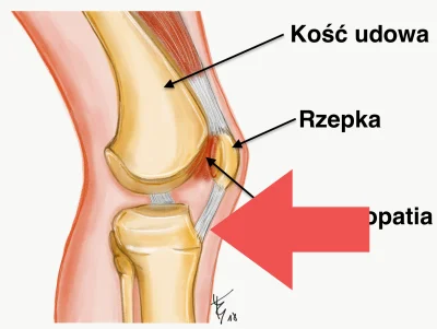 Fantomo - #medycyna #bieganie 

Coś mi jeblo w kolanie, nie wiem czy się uderzyłem, n...