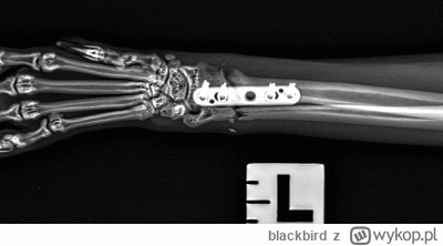 blackbird - najlepiej gifa otworzyc w osobnej karcie, świetnie widać postępujący zros...