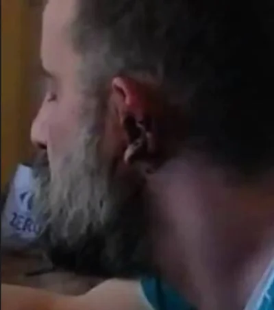 bizzi0801 - @Czolowy_zawodnik: on rozwalił sobie ucho czy to jest brud/rzygi?