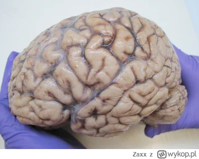 Zaxx - @Icouldbeyourmom: Taaa, bo mózg żywego człowieka to to samo co mózg, który zna...