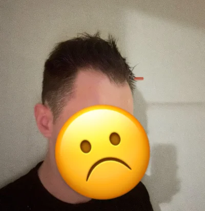 Giga_Przegryw - Da się z tym norwoodem coś zrobić, jakiś barber czy coś? Czy it’s ove...