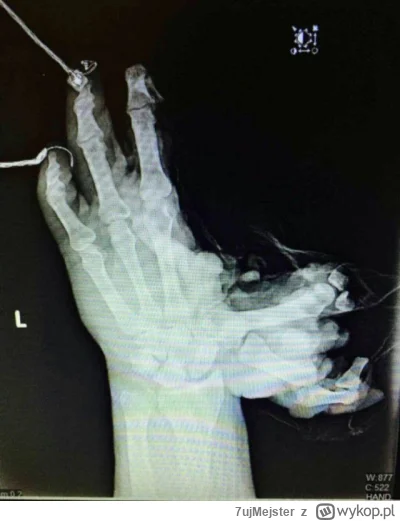 7ujMejster - Ciekawe ile Mirków czyta ten wpis i jest nieświadoma ze dziś może stracą...