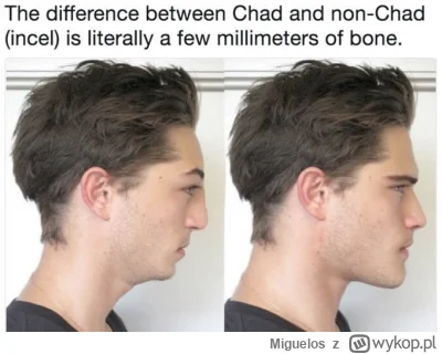 Miguelos - @Notes PO PROSTU NIECH CI UROŚNIE KOŚĆ BRO, TO ŁATWE BRO