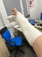 michal-skrzypik - Dajcie kilka plusów, chuop wywalił się w pracy i sobie palca złamał...