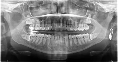 ladylurkini - ale jestem mądra, ja #!$%@?ę (⁠༎ຶ⁠ ⁠෴⁠ ⁠༎ຶ⁠)
#dentysta #stomatologia #z...