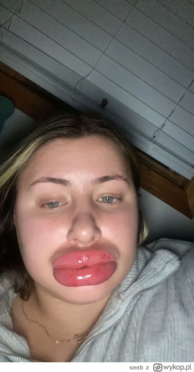 seeb - Gen słowiański, uaktywnia się najczęściej po 18 roku życia u kobiet płci żeńsk...