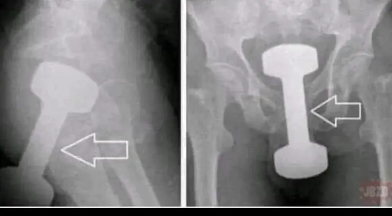 SannTi_25 - Cześć, byłem z kolegą na crosficie, akurat wypadł dzień mięśni kegla, jed...