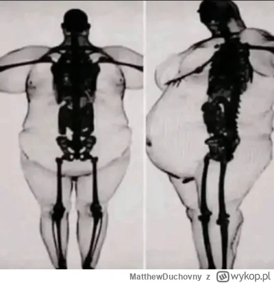 MatthewDuchovny - Grube kości? Chyba jednak nie. 

Przypomnienie, że nasze organizmy ...