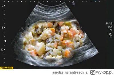 siedze-na-antresoli - Rozwój w normie.