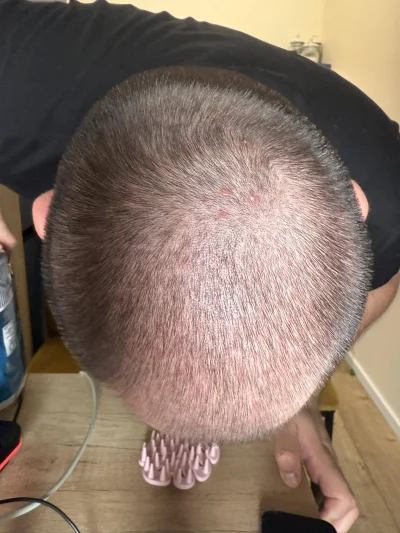 teoretyk_peklunku - Włosy huopskie do oceny #przegryw