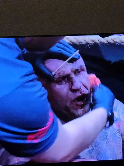 PodniebnyMurzyn - @Hissis ja tak wyglądam w każdy poniedziałek rano i to nie walcząc ...