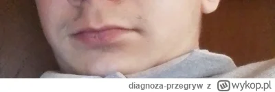 diagnoza-przegryw - @ZwalilemiNicNiePoczulem: u mnie to samo: