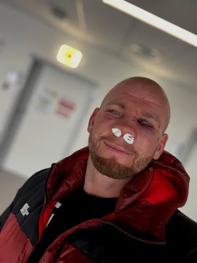 patrykgleba94 - Cześć Wykop tu Gleba, pozdrawiam z soru. 

Na wstępnie wybaczcie, że ...