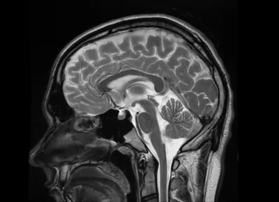 An-Dagda - @chlopiec_kucyk: no coz