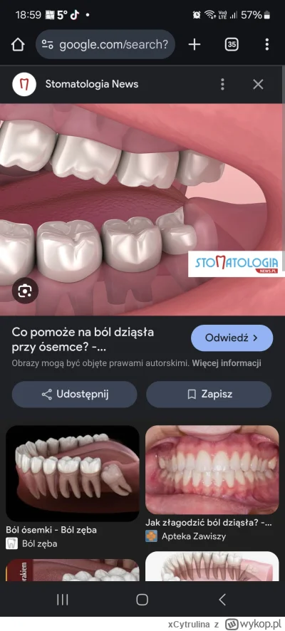 xCytrulina - #zdrowie #pomocy
Rośnie mi 8 ząb na dole, niestety w połowie rosnie na z...