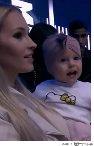 Uzapi - 100 plusów i wykładam 100k na przeszczep włosów w dubaju    #danielmagical