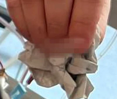 d.....a - >Sławek, obgryzasz?

@probak: Skylam paznokcia.