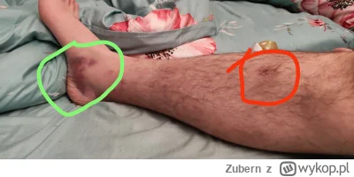 Zubern - Ostatnio dość mocno uderzyłem się w nogę w miejscu zaznaczonym na czerwono a...