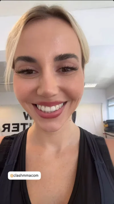 ZdzislawRotterdam - Zęby jak u konia #bekazpisu #schreiber