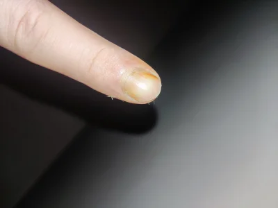Dzonsin - #papierosy #zolty #paznokcia

Wykopki, jak wyczyścić żółtego paznokcia? Pró...