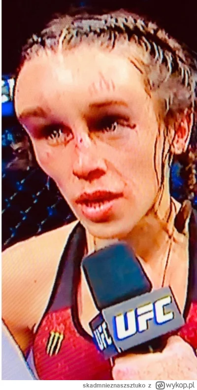 skadmnieznaszsztuko - @l--RAD--l