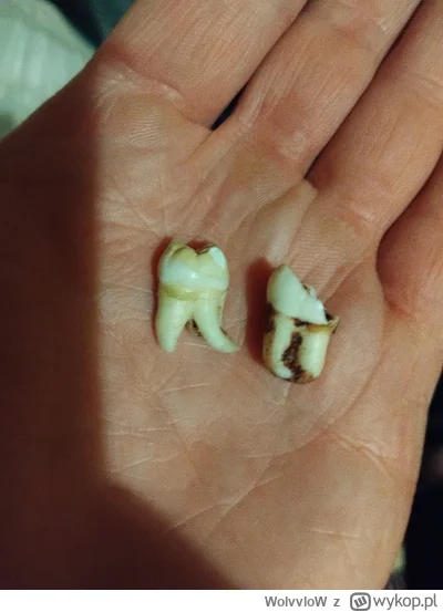 WolvvloW - @luz_arbuz98 gdzieś mam jeszcze 2