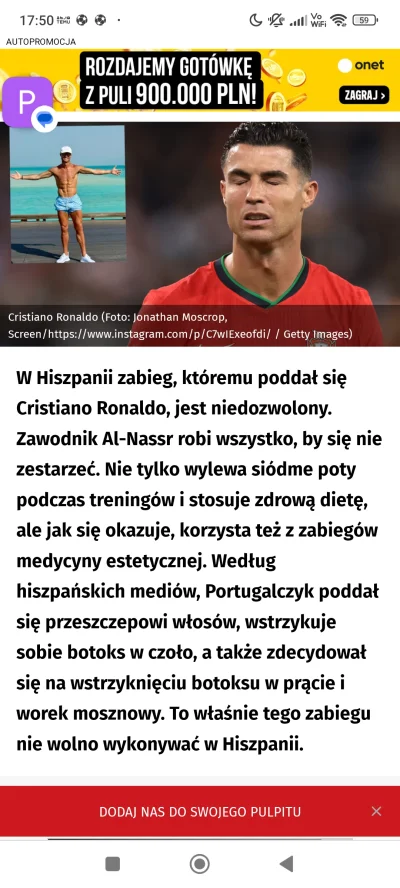 kaczeridi - Przeszczep włosów, w przypadku kiedy nawet nie ma zakoli? Okej, jedni pow...