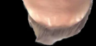 Puchacz93 - #sebcel panowie czy takie owłosienie na jajku to norma u was?