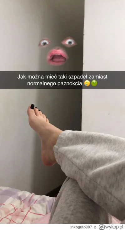 Inkoguto007 - Fu #rozowepaski #niebieskiepaski